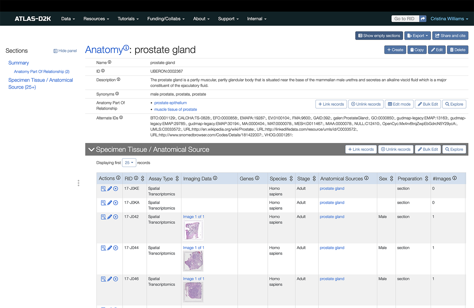 Anatomy page for prostate gland