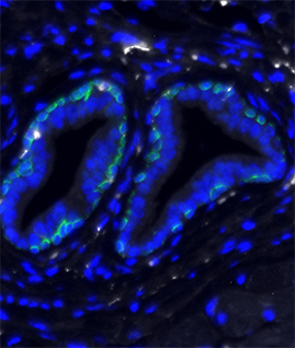 16-WMWC-prostate-mouse-strand