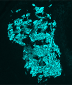 17-CKXJ-southard-smith-ihc