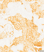 N-E03T-Little-IHC