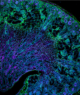 anxa2-1-carroll-mouse
