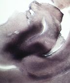 mendelsohn-ISH-N-EJET