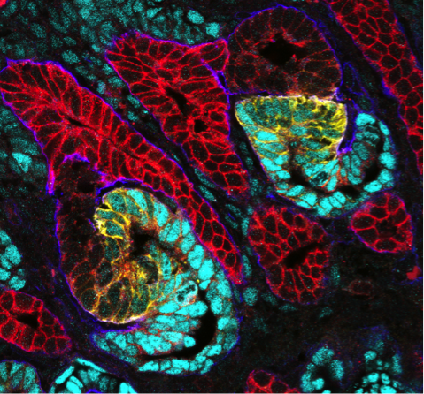Nephron Patterning In The Human Kidney
