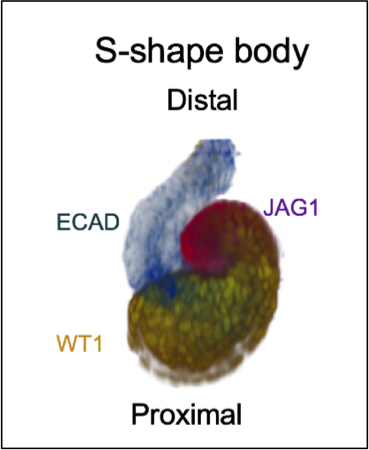 Comparing mouse and human kidnes