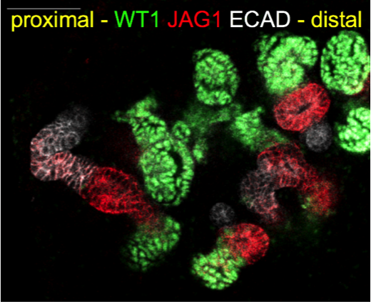 Nephrons Forming In A Human Kidney Organoid Model System